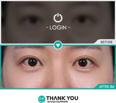 Before & After
