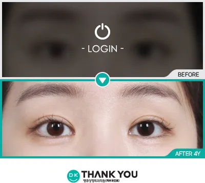 Before & After