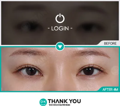Before & After