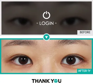 Before & After