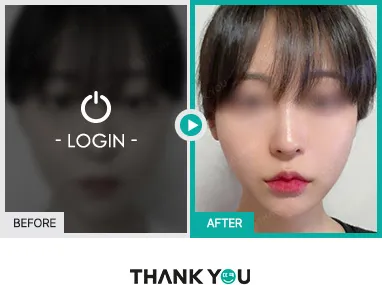 Before & After