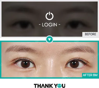 Before & After