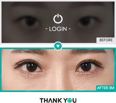 Before & After
