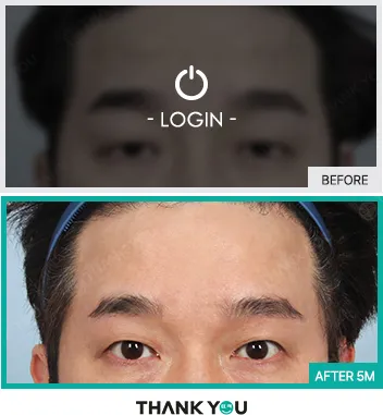 Before & After