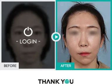 Before & After