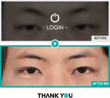 Before & After