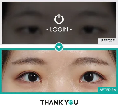 Before & After