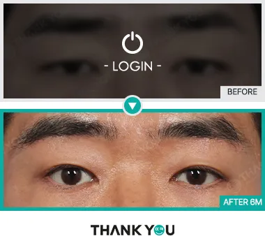 Before & After