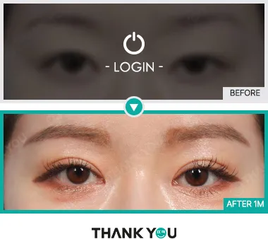 Before & After