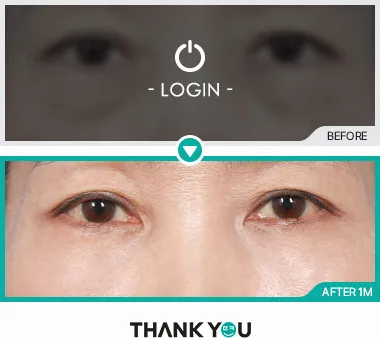 Before & After