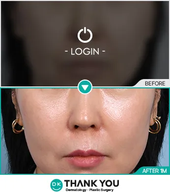 Before & After