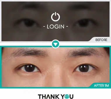 Before & After