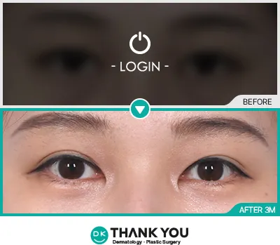 Before & After