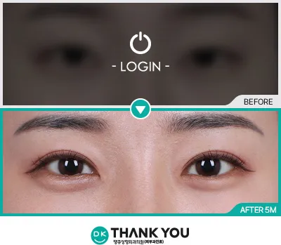 Before & After