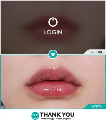 Before & After