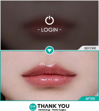 Before & After