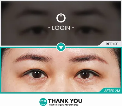 Before & After