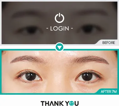 Before & After