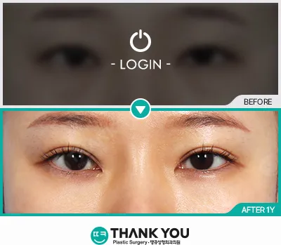 Before & After