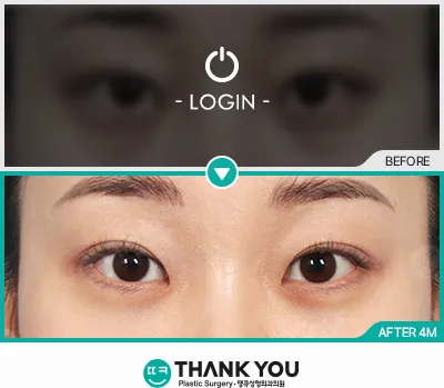 Before & After