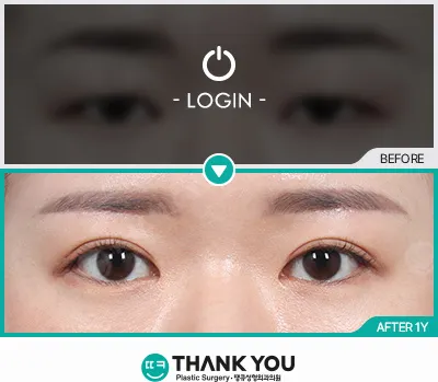 Before & After