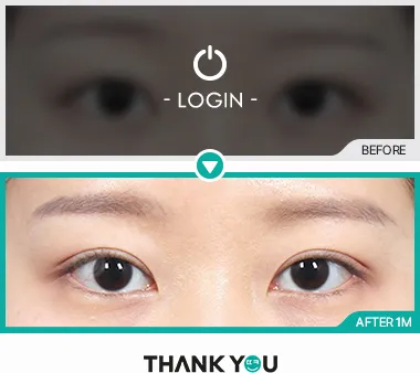 Before & After