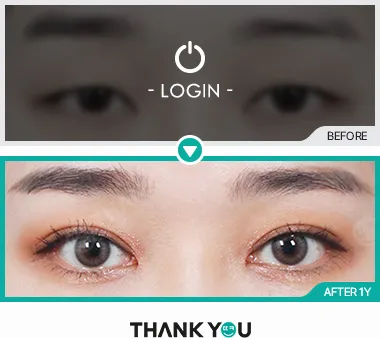 Before & After