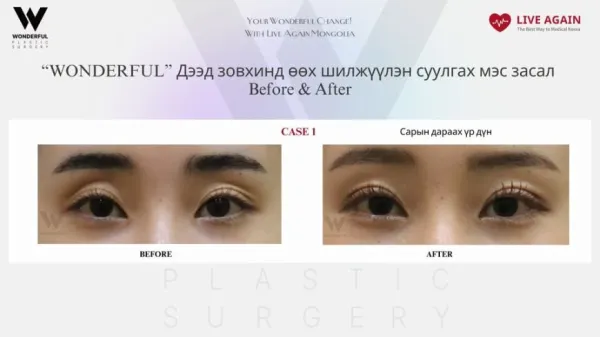Your Wonderful Change! With Re Beauty Mongolia  "Wonderful"  Гоо сайхны мэс заслын эмнэлэг