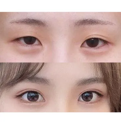 手術して3ヶ月目です。