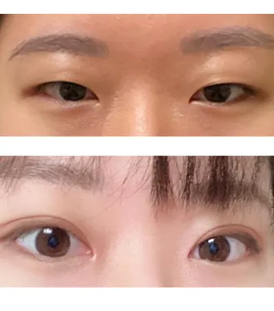 ベリーグッド整形外科、超おすすめです^ㅡ^