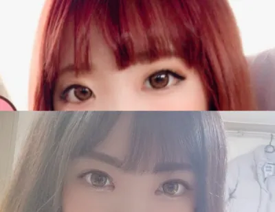 目の手術体験談