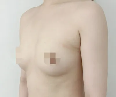 セビンサブ6ヶ月目) ☆75Bから65E☆ 非対称改善まで☆