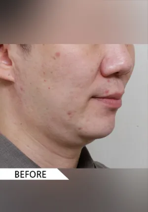Before