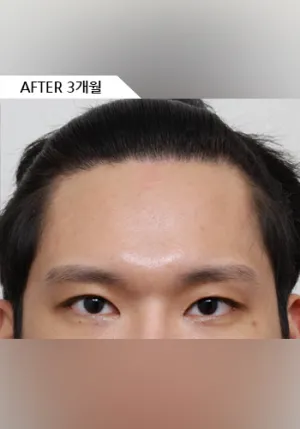 After