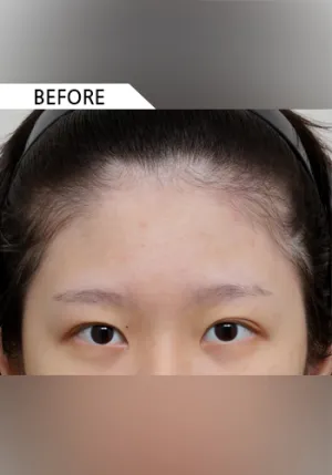 Before
