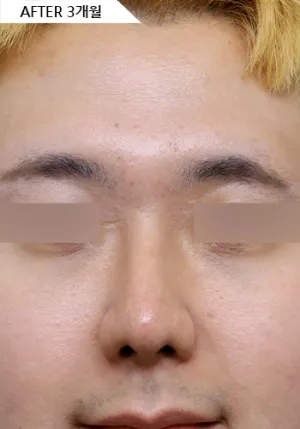 After