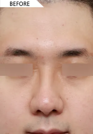 Before