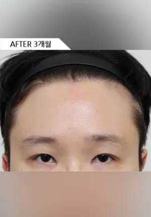 After