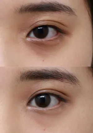 After