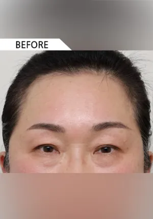 Before
