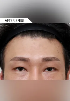 After