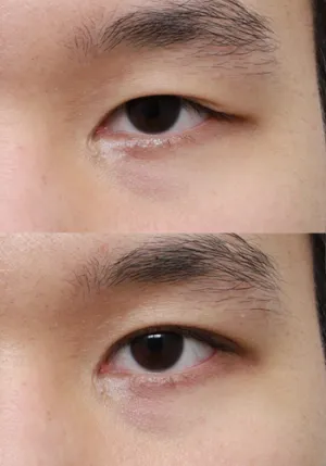 After