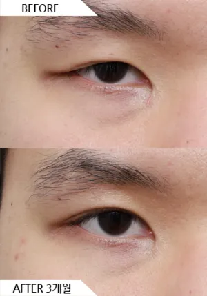 Before