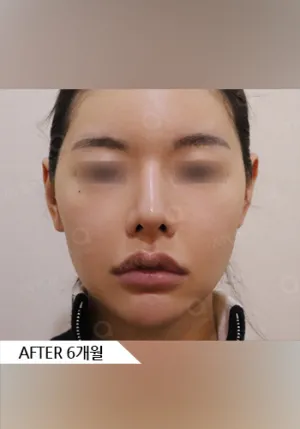 After