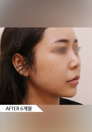 After