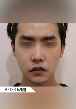 After