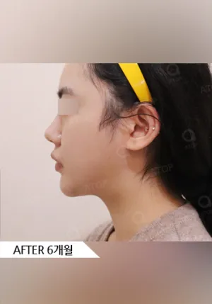 After