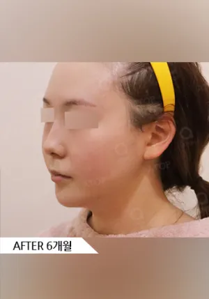 After