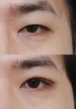 After