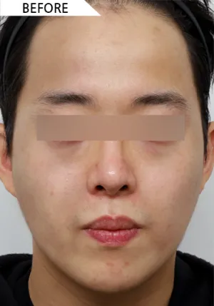 Before